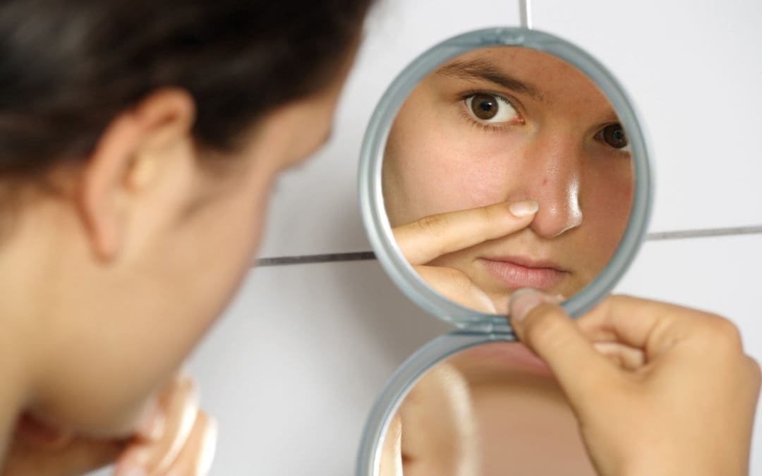 For acne that just won’t go away…