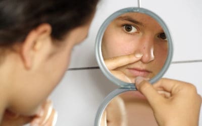 For acne that just won’t go away…