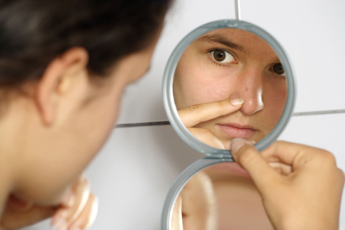 For acne that just won’t go away…