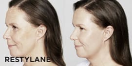 Restylane