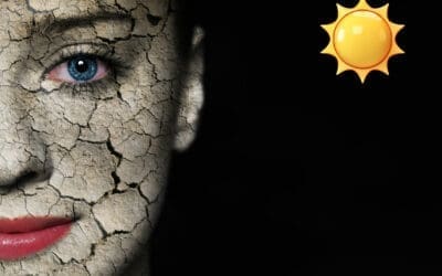 Summer Dry Skin