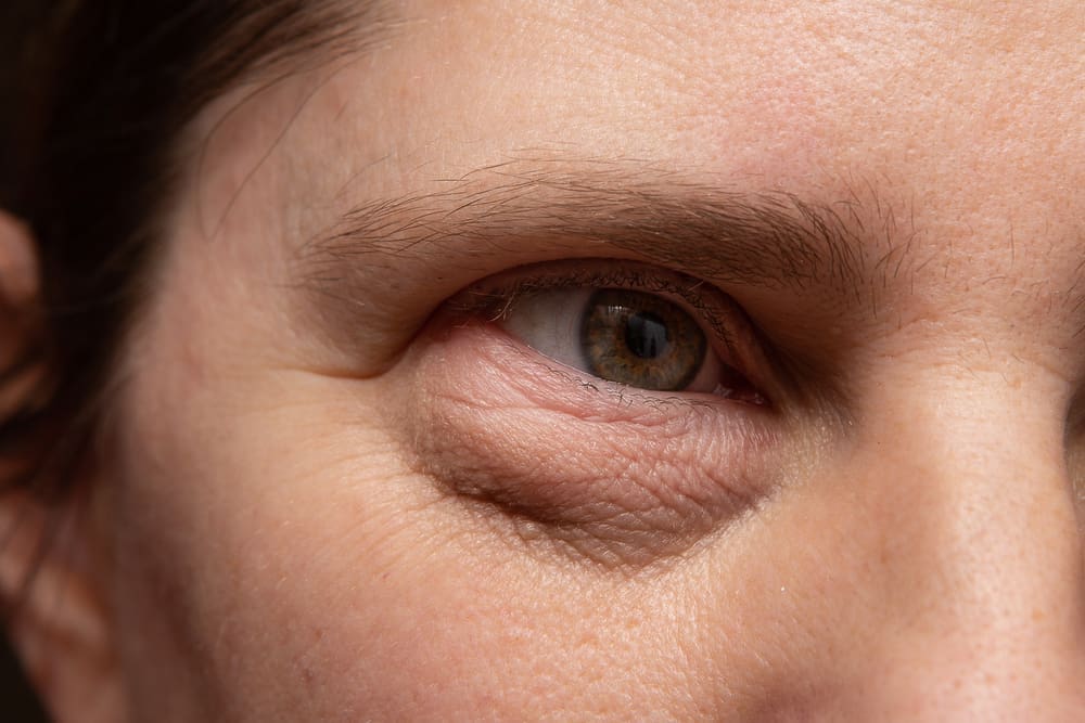 Brighten Up! 🌟 Tips for reducing under-eye bags.