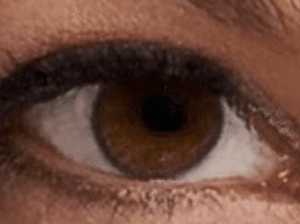 Dry eye relief